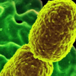 La UNAM advirtió sobre una superbacteria que ya preocupa a nivel mundial